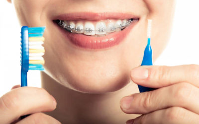 Как ухаживать дома за зубами и какие современные пломбы и импланты самые долговечные