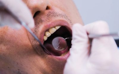 Тюменские стоматологии изменили цены на лечение зубов
