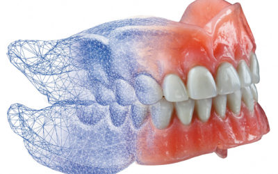 Самые распространенные легенды и мифы в области имплантации зубов
