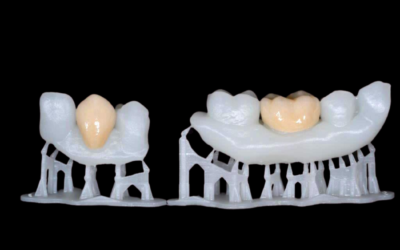 3D-печать: история и начало новой эры технологий в стоматологии